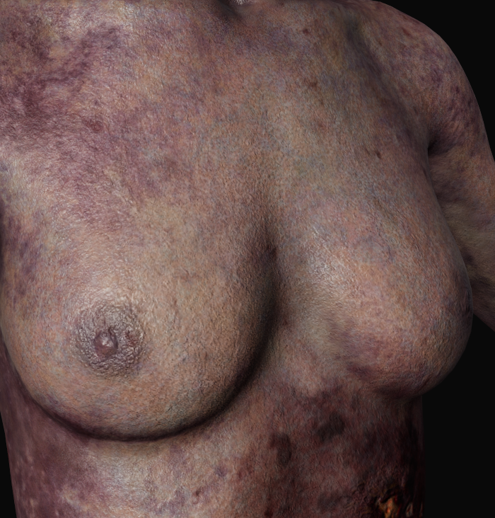 Annie - Body Details 2