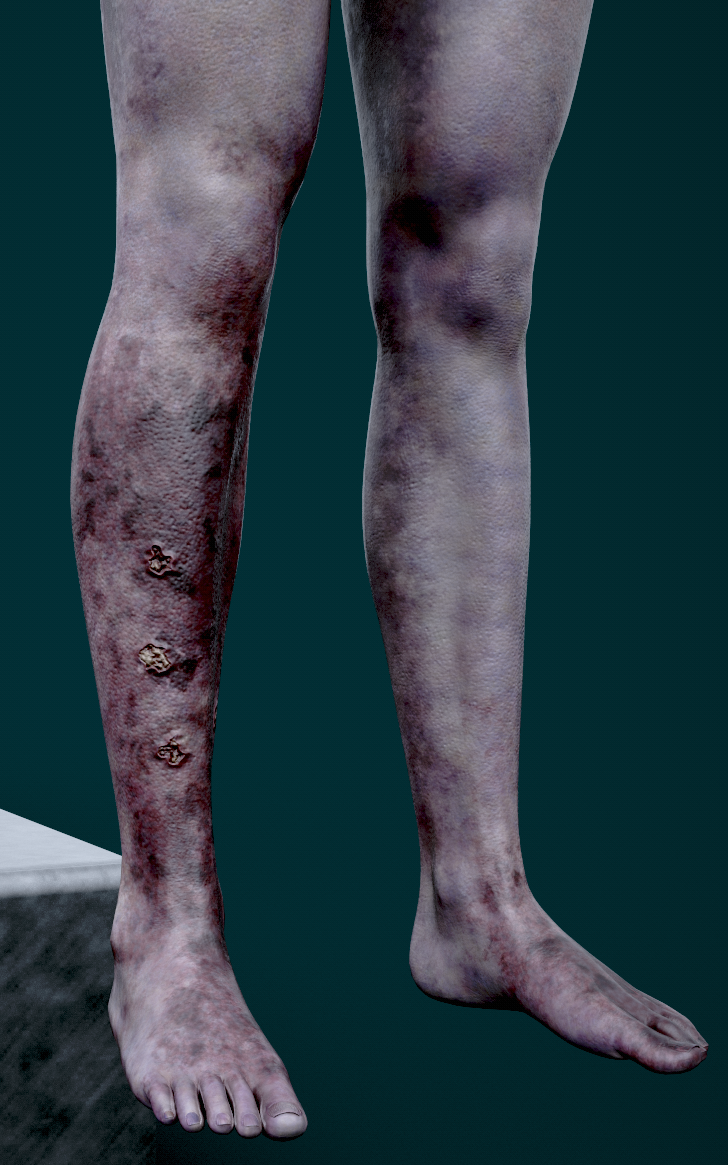 Annie - Leg Injury Details