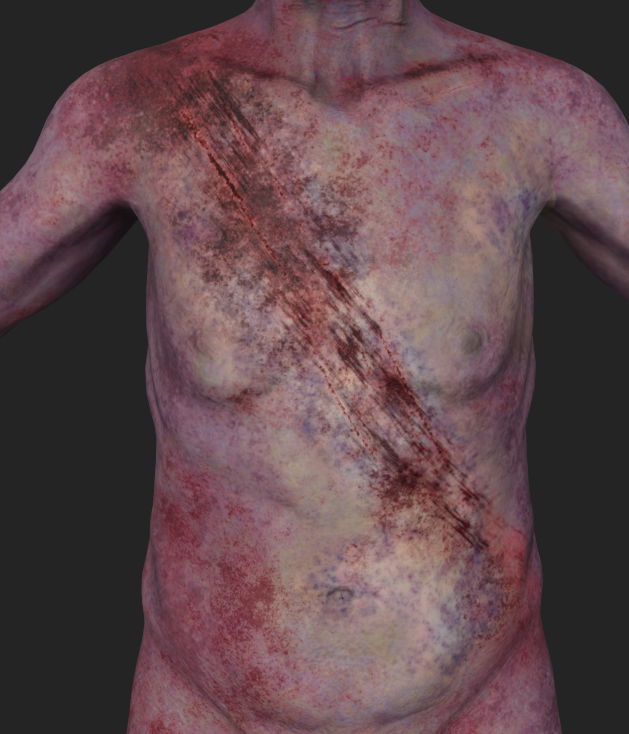 Old Man - Injury Detail 2