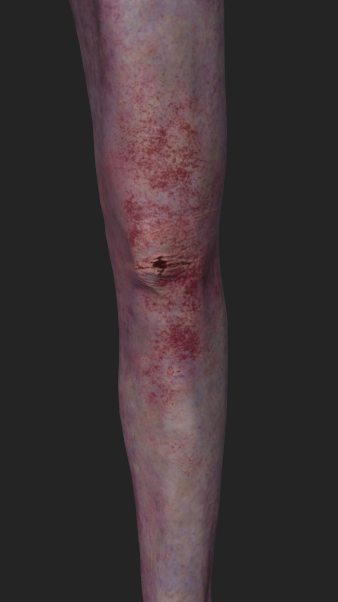 Old Man - Injury Detail 3