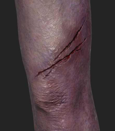Old Man - Injury Detail 4