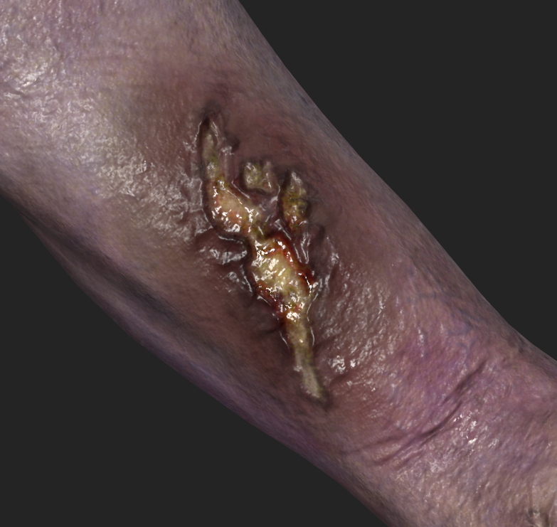 Old Man - Injury Detail 5