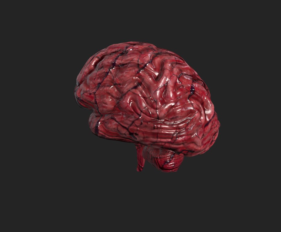 Brain with Hemorrhage