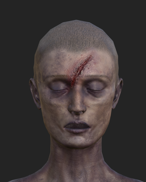 Samantha - Injury Detail 1