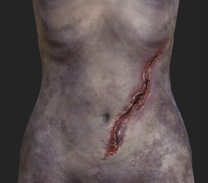 Samantha - Injury Detail 2